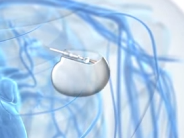 Electroceuticals: de toekomst van geneeskunde