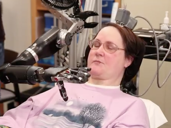 Robotarm besturen via hersenen